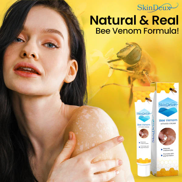 SkinDeux™ Bee Venom Vitiligo Cream - 30-Days Money-Back Guarantee!