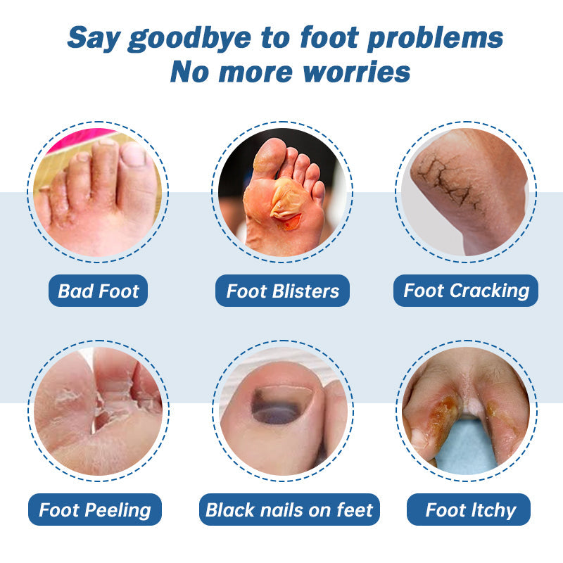 👏Furzero™ Medical Grade Nail Fungus Foot Spray