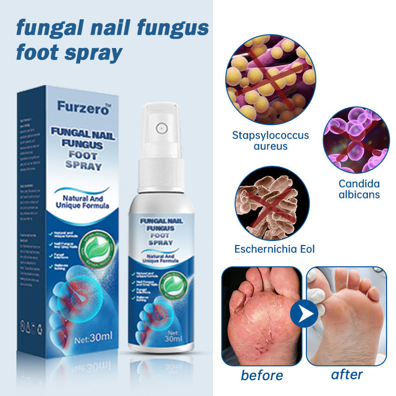 👏Furzero™ Medical Grade Nail Fungus Foot Spray