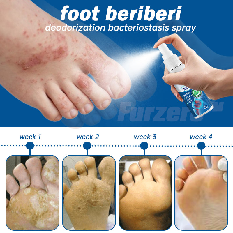 👏Furzero™ Medical Grade Nail Fungus Foot Spray