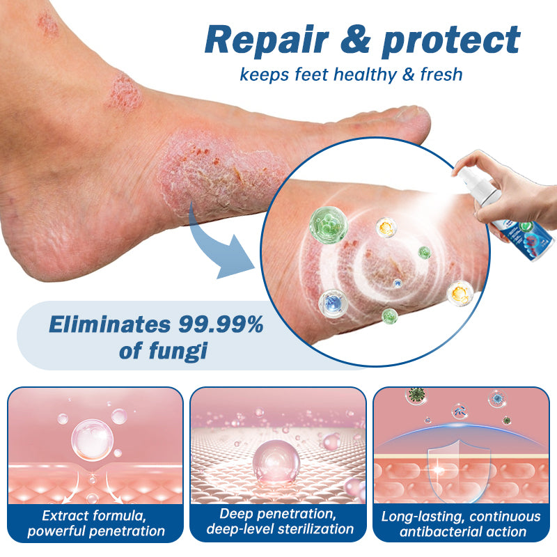 👏Furzero™ Medical Grade Nail Fungus Foot Spray