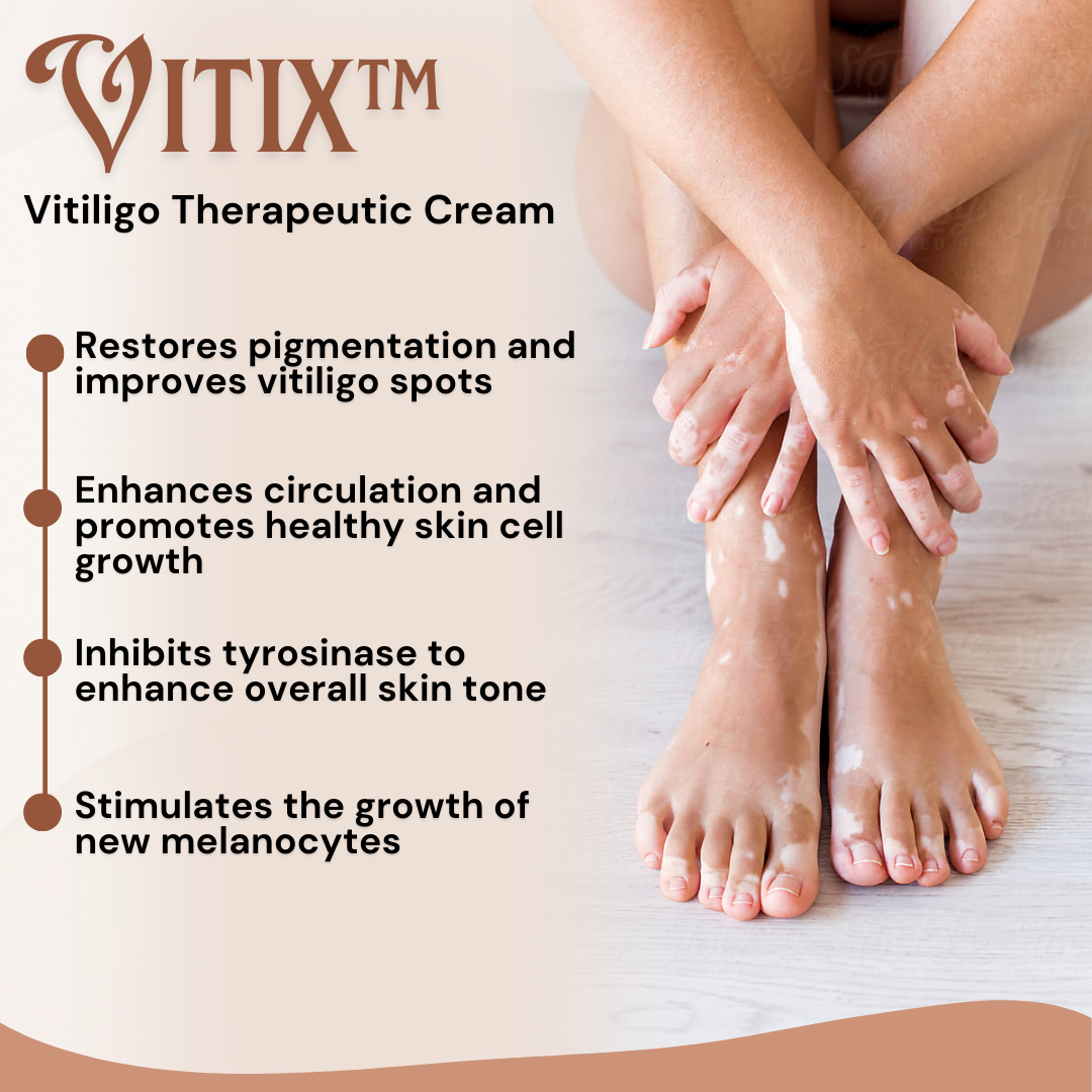 VITIX™ Vitiligo Therapeutic Cream - Sale at 80% discounts today!