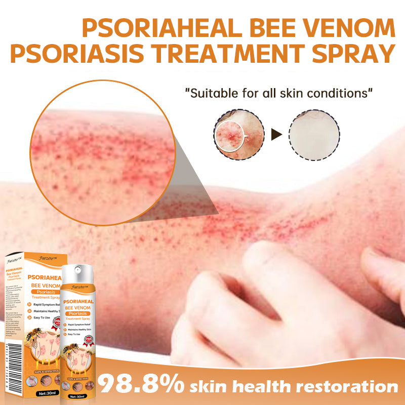 Furzero™ PsoriaHeal Bee Venom Psoriasis Treatment Spray(Suitable for all skin conditions)