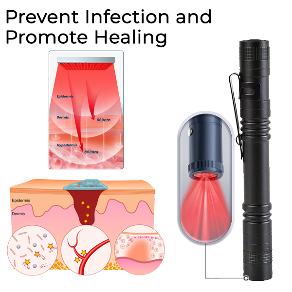 Fivfivgo™ Wound & Ulcer Healing Infrared Pen