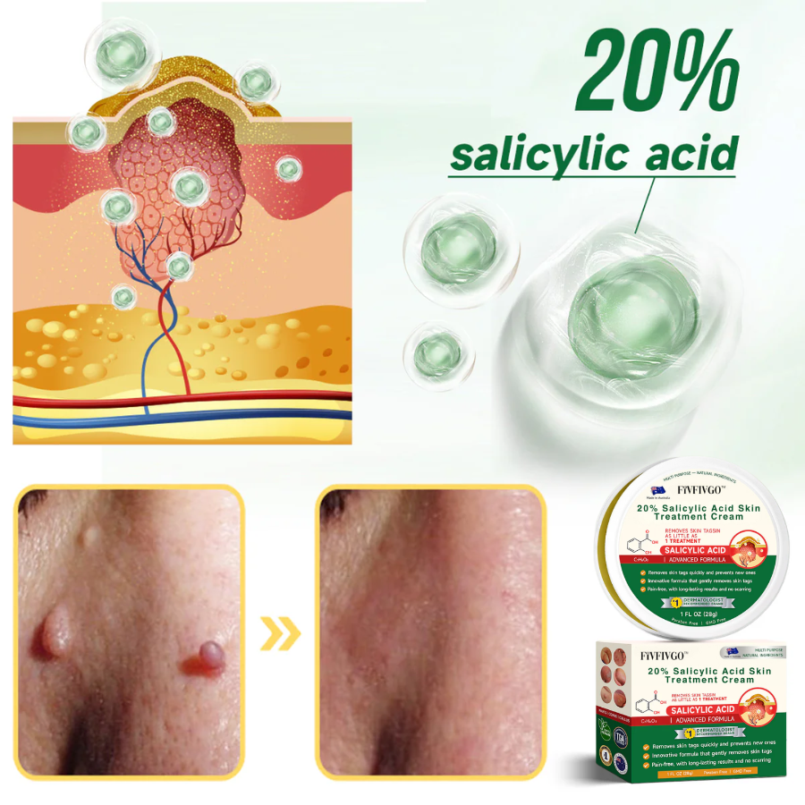 Fivfivgo™ 20% Salicylic Acid Skin Treatment Cream