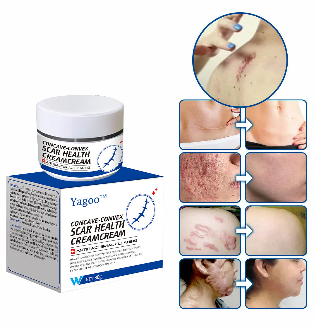 YAGOO™ Advanced Scar Removal Cream(Say goodbye to scars in 7 days)