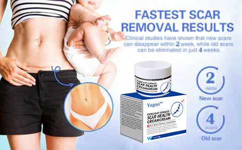 YAGOO™ Advanced Scar Removal Cream(Say goodbye to scars in 7 days)