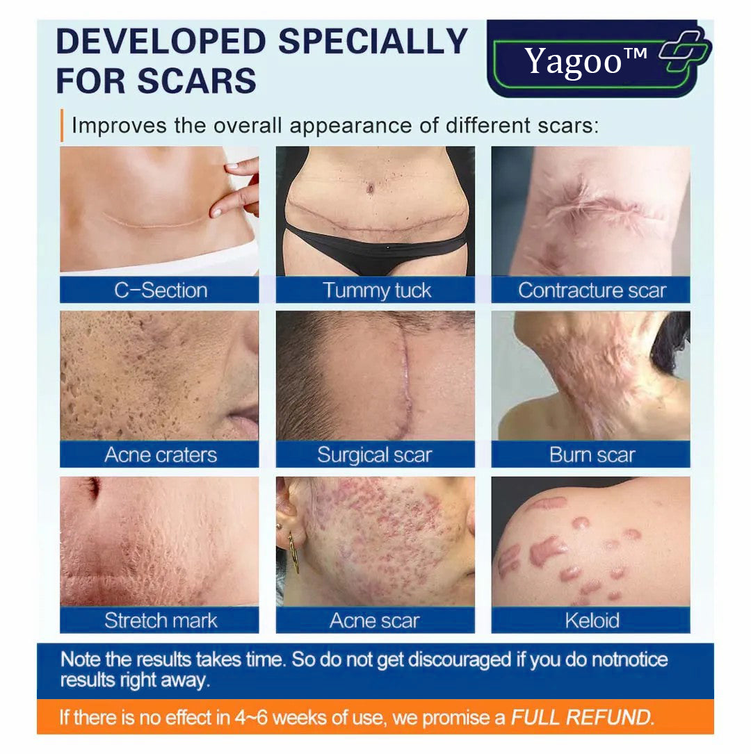 YAGOO™ Advanced Scar Removal Cream(Say goodbye to scars in 7 days)