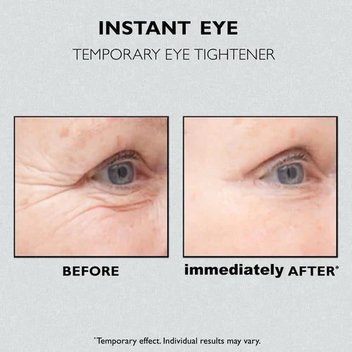 Seurico™ Instant Firm Eye Tightener💕