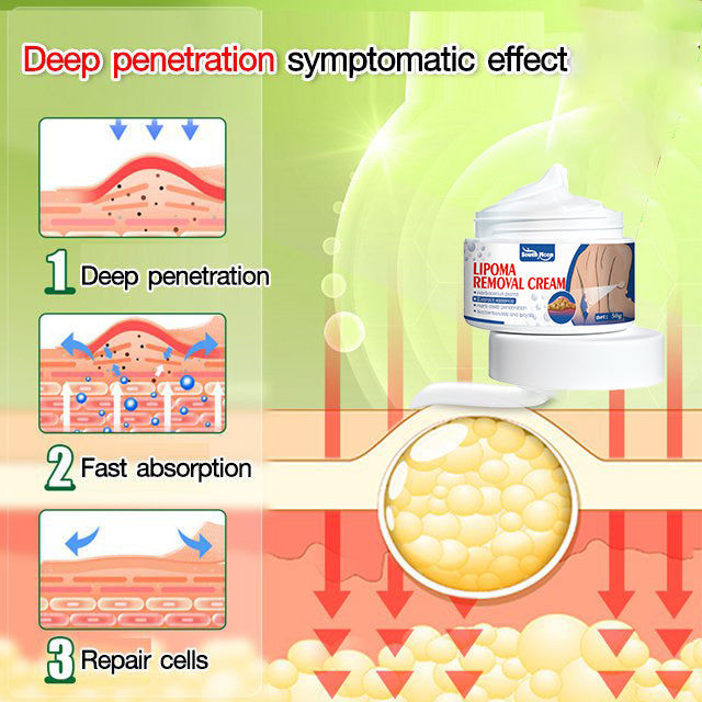 [South Moon Lipoma Cream]New generation Fat Dissolving Cream !!