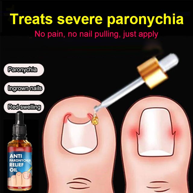 ANTI PARONYCHIA RELIEF OIl【 Cash On Delivery】