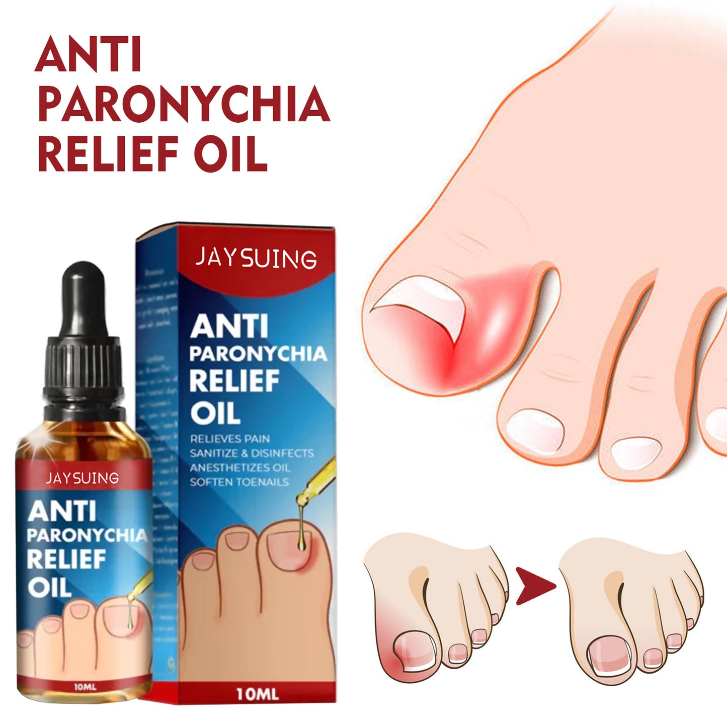 ANTI PARONYCHIA RELIEF OIl【 Cash On Delivery】