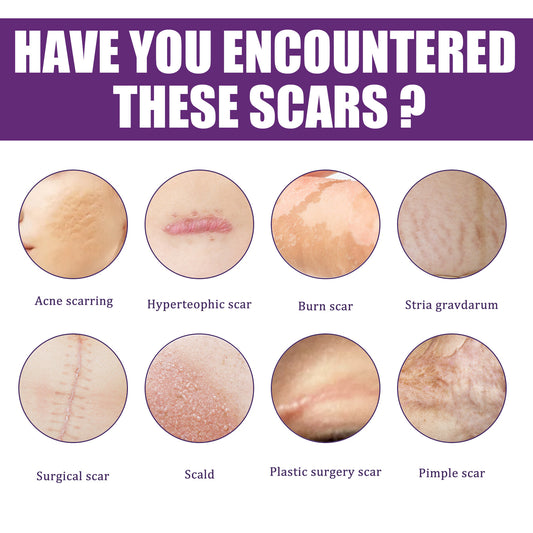 SILICONE SCAR SHEETS [SCAR REDUCTION THERAPHY]