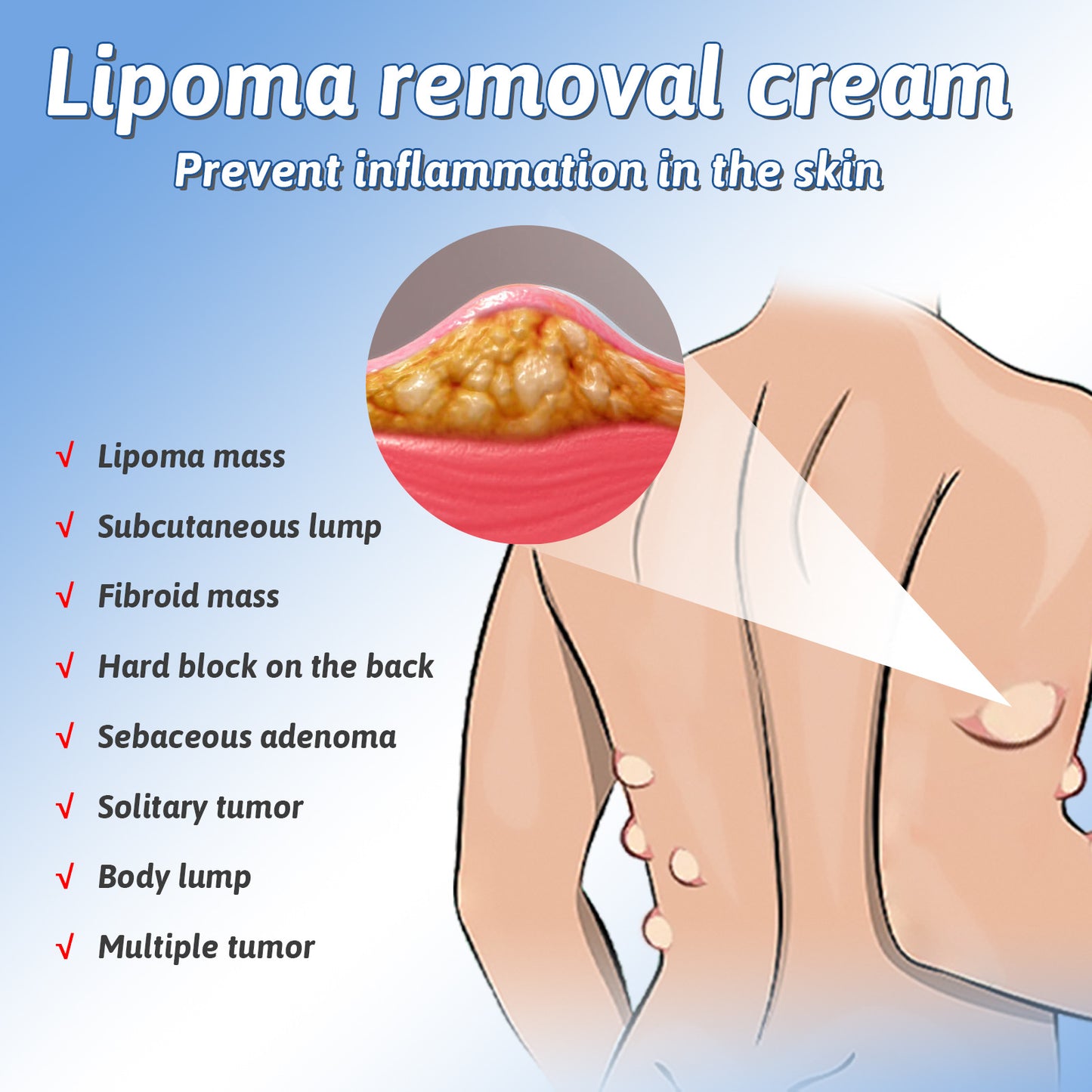 [South Moon Lipoma Cream]New generation Fat Dissolving Cream !!