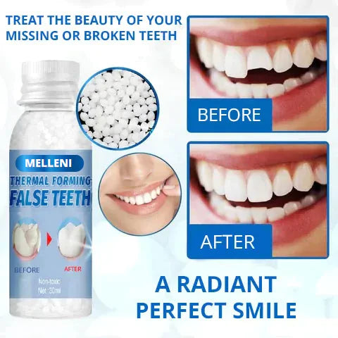 Temporary Tooth Gap Repair Kit (49% off)⭐⭐⭐⭐⭐